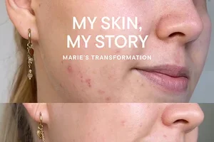 Maries Skin Story: Was ihrer Mischhaut guttut