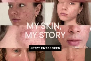 My skin, my story: Entdecke, was deine Haut wirklich braucht