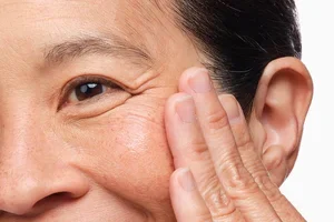 When fine lines meet peptides.