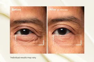 Coming soon: PDRN for your eyes.
