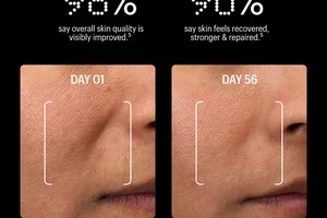 Fade Dark Spots While You Sleep 🌙